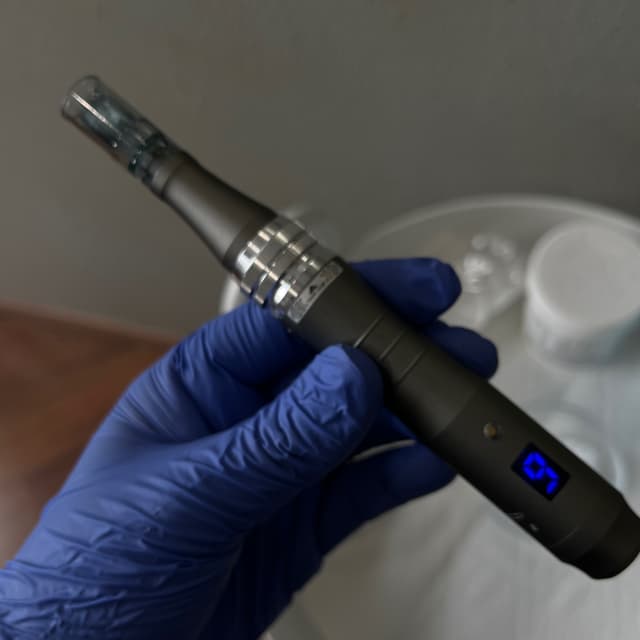 Microneedling Package of 3 at Essentials By Ebonnie in Henderson, NV